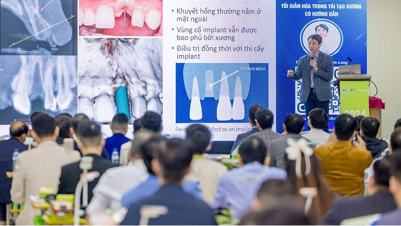 Buổi giảng bài về "Tối giản hoá trong tái tạo xương có hướng dẫn" tại VIDEC 2025 của TS.BS Nguyễn Khánh Long với vai trò báo cáo viên